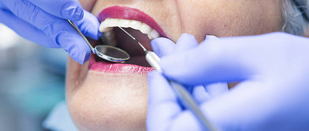 Best Emergency Root Canal Treatment in University Of Lifornia Davis, CA